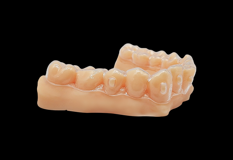 什么是3d打印正畸牙模？3d打印正畸牙模怎么做？